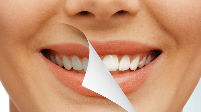 clareamento-dental-nks-odonto