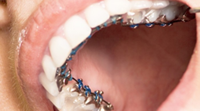 ortodontia-nks-v2