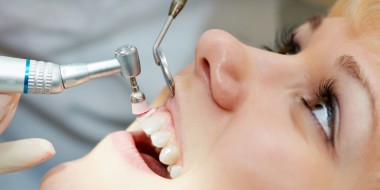 Periodontia: cuidados com as estruturas de suporte dos dentes que fazem toda a diferença na saúde e na estética bucal.